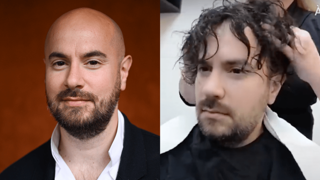 La prothèse capillaire réaliste portée par Kyan Khojandi, conçue pour susciter des réactions sincères.